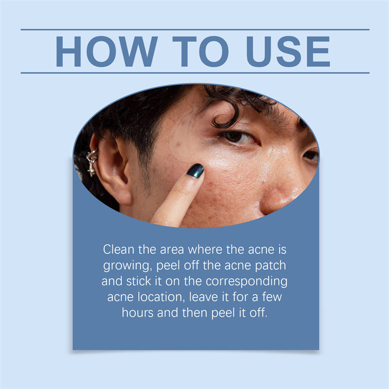 Hydrocolloid Acne Patches