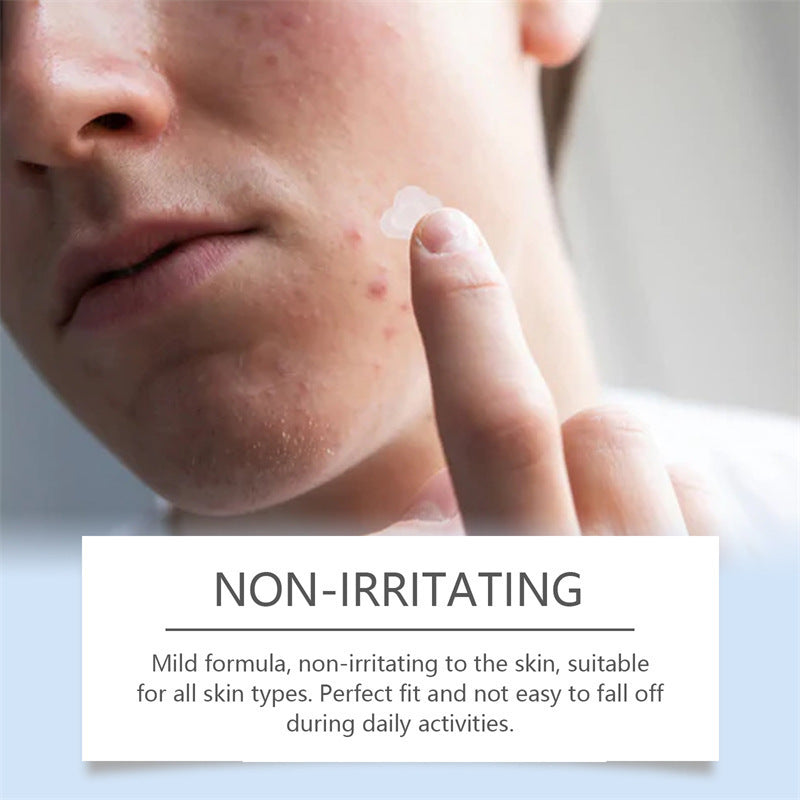 Hydrocolloid Acne Patches