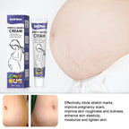 Stretch Marks Skin Repair Cream