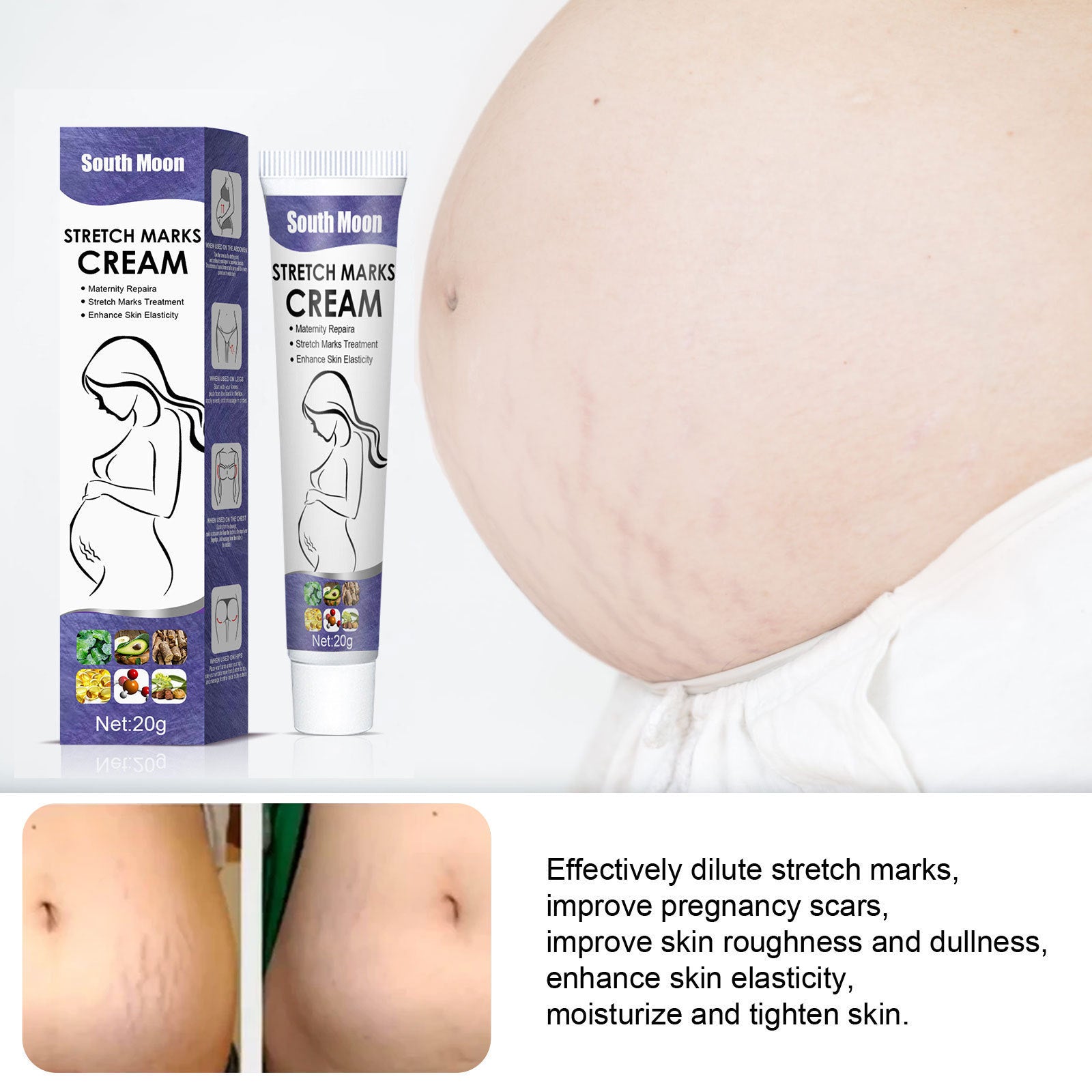 Stretch Marks Skin Repair Cream